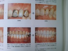 やまもと歯科クリニックのブログ